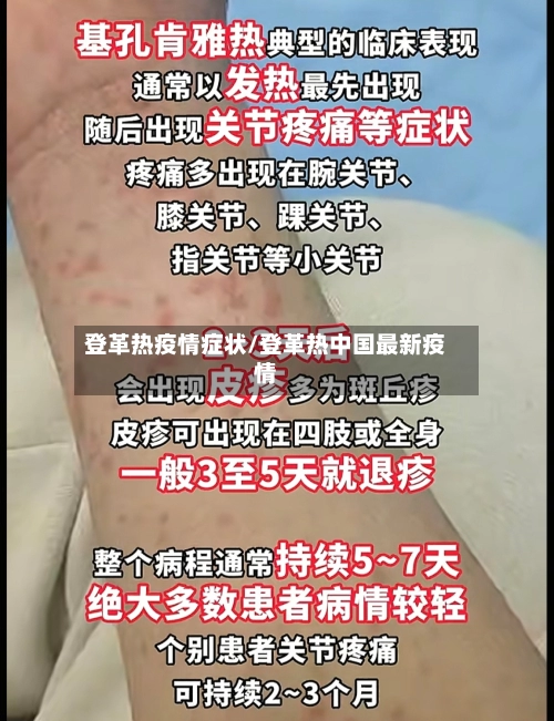 登革热疫情症状/登革热中国最新疫情